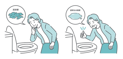 大腸カメラ前処置の便の状態比較イラスト（高齢女性・泥状便NG・透明な水様便OK）