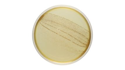 Bacteria Culture in Petri Dish