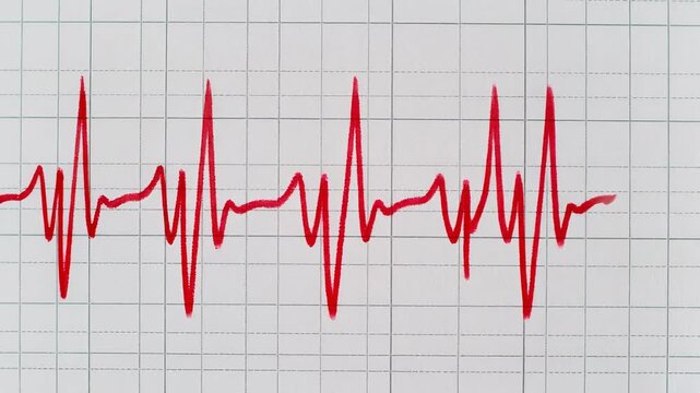 Close-up of a red ECG heartbeat rhythm on a grey grid paper with a medical theme.