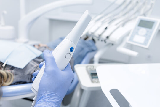 Intraoral 3D Scanner for Digital Impression and CAD CAM Workflow in Dental Clinic