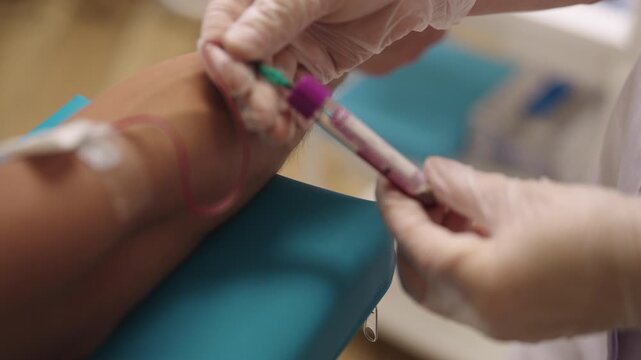 Healthcare professional drawing blood from patient arm into vacuum tube for medical testing, diagnosis, and pathology analysis in clinical laboratory, close-up. Shooting in slow motion.