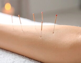 Close-up of a person's arm receiving acupuncture. Needles are inserted in the skin, with one in soft focus background