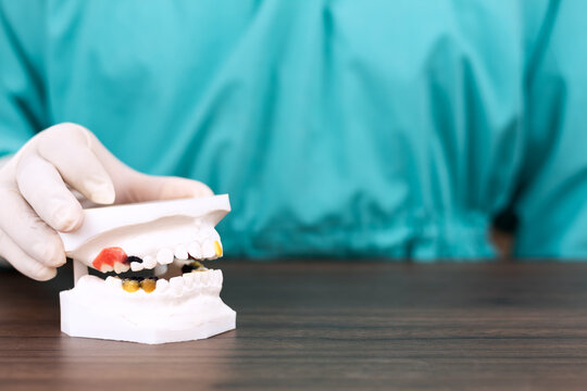 A dentist displays a plaster model of a jawbone. Dental restoration planning; concept of oral aesthetics, comprehensive oral rehabilitation, smile design, clinical diagnosis.