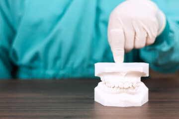 Orthodontic diagnostic model of the jaws in plaster  dental alignment planning for malocclusion, cephalometric study, specialized clinical care. Dentist points to a model of the mandible with teeth. © Tom