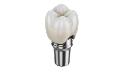 Isolated tooth implant with crown, dental care restoration, molar replacement, and dentistry
