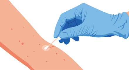 Dermatologist or scientist in a blue glove using a cotton swab to take a sample from a patient's skin rash.
