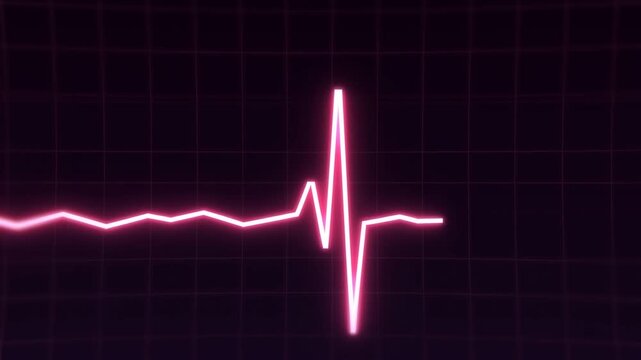 Visual Representation of Heart Rate Variability Displayed on a Digital Monitor, Illustrating the Pulsating Nature of Cardiac Activity in a High-tech Setting