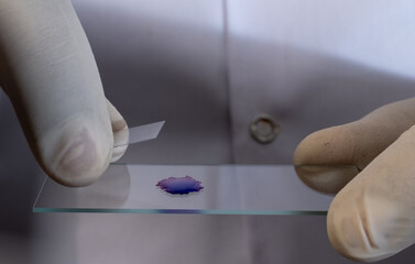 Medical technician in gloves preparing a stained specimen slide lab