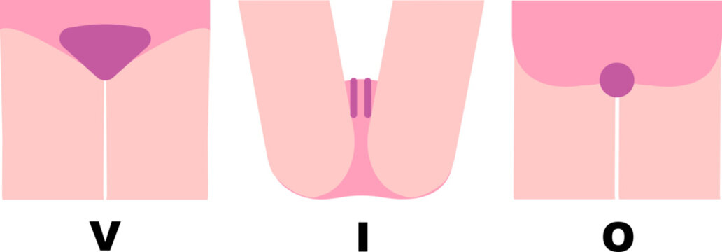 Vector illustration set of VIO hair removal areas for women (V-line, I-line, O-line)
