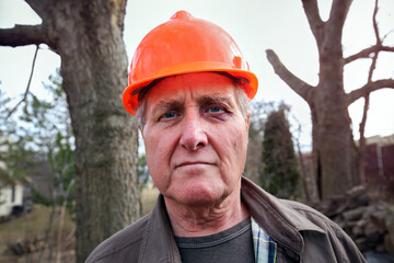 Senior homeowner with a black eye and wearing a hardhat pausing after cutting branches on a dead tree