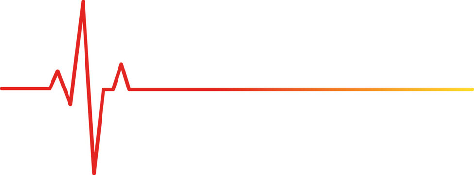 Electrocardiogram signal