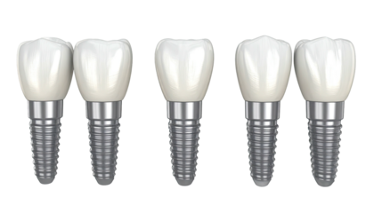 Five dental implants, close-up, illustrating teeth replacement, white