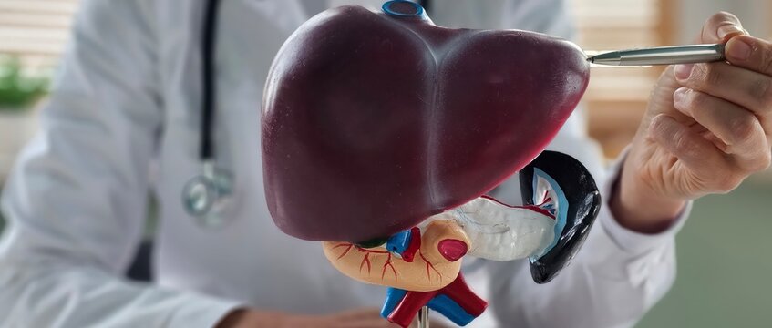 Doctor holding human Liver anatomy model. Liver cancer