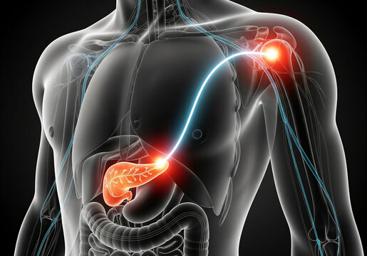 Phrenic Nerve Referred Pain Pathway from Pancreas to Shoulder