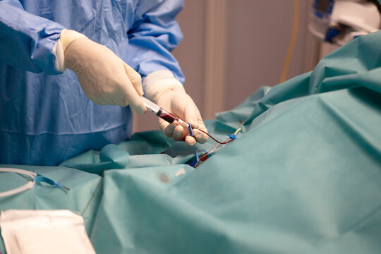 Nurse inserting peripheral venous line in hospital ICU