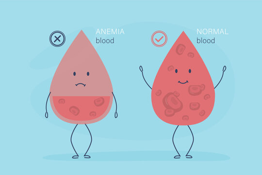 Normal blood and specimen with anemia disease. Blob of human blood, cells structure. Thrombocytes, leukocytes and erythrocytes under microscope. Microbiology test