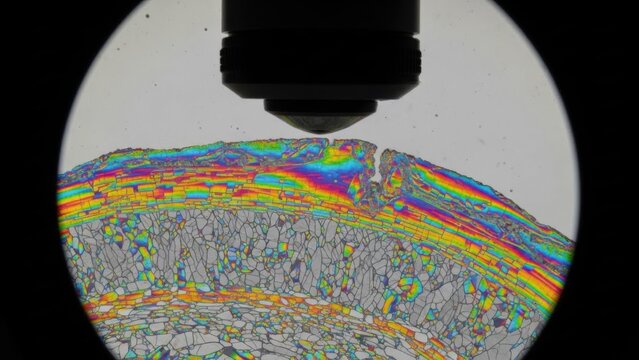 Birefringent microscopic view of biological tissue under polarized light revealing vibrant