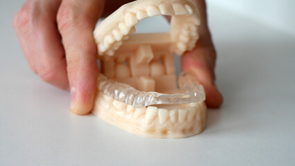 Close-up of a 3d dental mold with a splint on the lower teeth row in a male hand