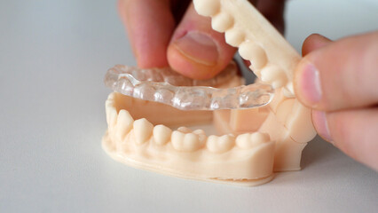 A man inserting a splint into a 3d dental mold close-up