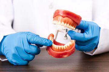 Doctor wearing blue gloves holding a dental model for patient education on oral hygiene, demonstration of brushing techniques and prevention of periodontal disease