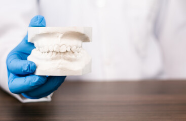 Plaster casts of human teeth for oral surgery simulation, dentist showing maxillary structure, technical planning of dental health and static medicine. © Tom