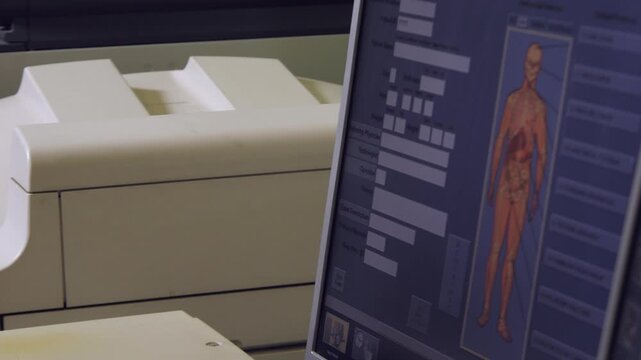 Laser imaging machine printing x-ray of CT scan, radiology diagnosis
