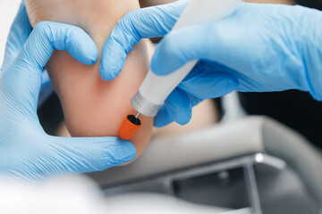 Obraz premium Professional foot treatment by podiatrist using specialized tool, heart symbol