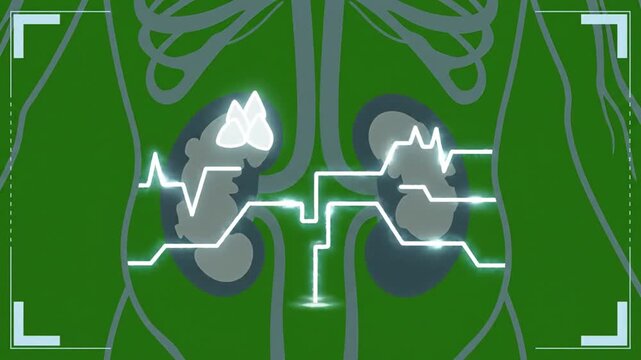 Sci-Fi AR Depiction of Adrenal Insufficiency with Kidneys and Heartbeat Traces on Green Screen Background Augmented