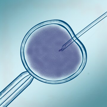 In vitro fertilization and assisted reproductive technology concept. Medical illustration of ivf process where the needle injects sperm into an egg.