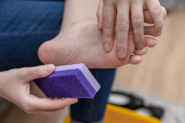 Scrub dry heels with a pumice stone, foot close-up