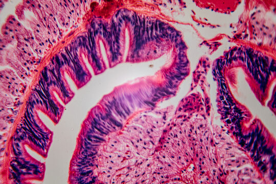 Histological section of the intestinal mucosa, showing villi, epithelial cells, and nuclei in bright staining.