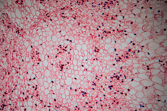 Microscopic image of heart muscle tissue stained in red, showing branched muscle fibers, centrally located nuclei, and intercalated discs for histological analysis.
