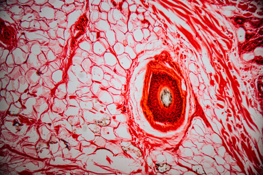 Microscopic image of human skeletal muscle tissue showing organized striated fibers stained in red, highlighting muscle bundles and connective tissue divisions.