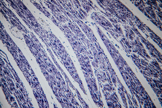 Microscopic view of heart muscle tissue stained in blue, showing elongated, striated muscle fibers with centrally located nuclei arranged.