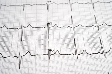 Red heart on electrocardiogram ECG with red heart, heart wave, heart attack, cardiogram report.