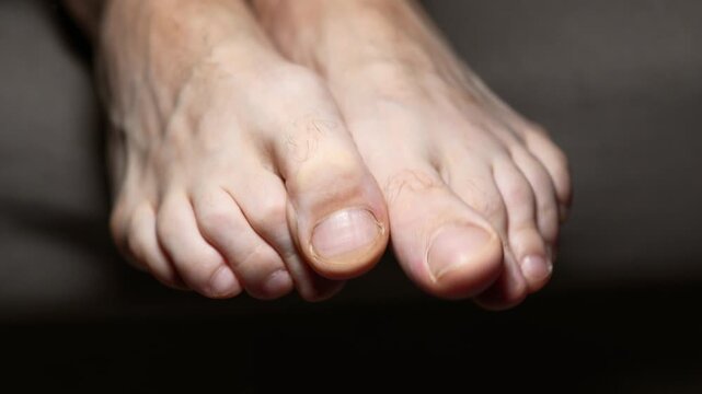 A close-up of a man's foot.
A close-up of the heel of a man's foot.
A man wiggling his toes.
Body parts