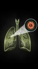 A green glowing lungs with zoomed disease mass showing a medical scan and lung diagnosis asthma concept