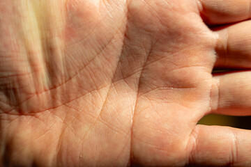 Fototapeta premium Close-up of a human hand with detailed skin texture illuminated by sunlight. The image captures the unique characteristics of a hand, showcasing individual lines and patterns.