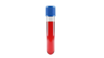 Single Test Tube Containing Red Blood Sample with Blue Cap on Black Background