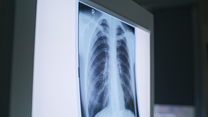 Medical professional examining x-ray clinic closeup. Doctor analyzing images