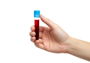 Hand holding a blood sample tube with a blue cap is presented for medical analysis and diagnostic testing in a laboratory setting, symbolizing healthcare research.
