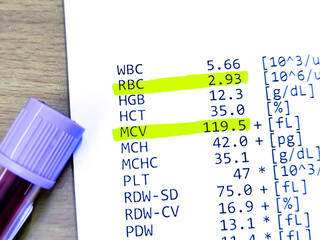 Hematological report: Low RBC and High MCV, Suggestive of Pernicious anemia or Alcoholic liver disease or Bone marrow disease.