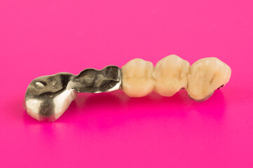 ceramic dental bridge isolated on sold surface