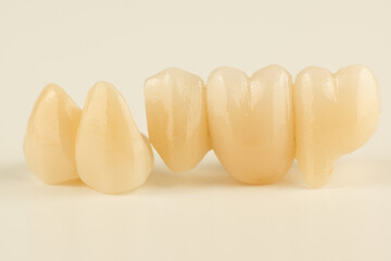 ceramic dental bridge isolated on sold surface