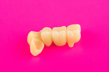ceramic dental bridge isolated on sold surface