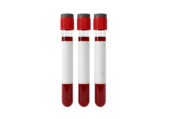 Three red capped test tubes with red liquid samples Isolated on transparent background