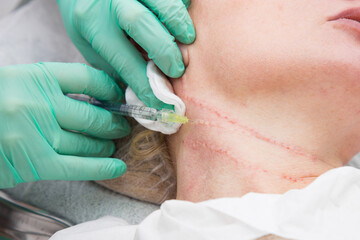 Smoothing female neck skin with injections in neck at cosmetic clinic. Neck skin rejuvenation and contouring, mesotherapy and biorevitalization