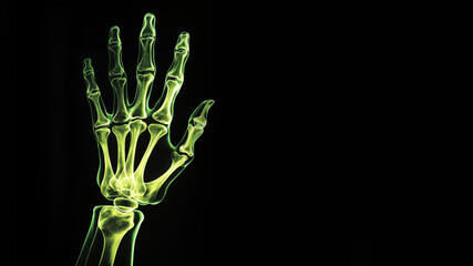 X-ray hand bones with copy space on black background. Radiology concept.