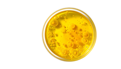 Petri dish with yellow liquid and circular bacterial colonies against a stark black backdrop