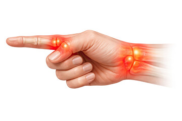 Human pointing hand anatomy showing finger and wrist joint pain inflammation arthritis close up isolated on white background